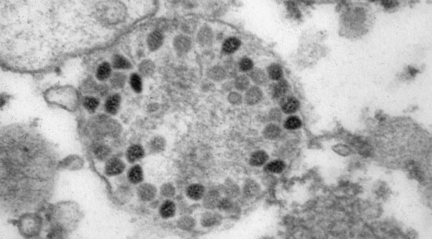 Imagem da variante Ômicron divulgada por cientistas russos Instituto Galameya/divulgação